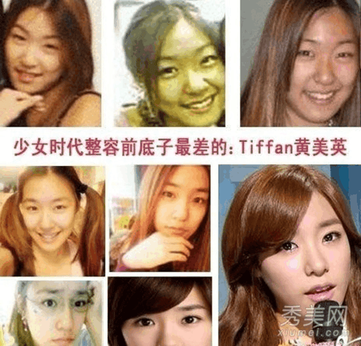 黄美英整容前,黄美英照片(黄美英出道前照片) 黄美英整容前,黄美英照片(黄美英出道前照片)