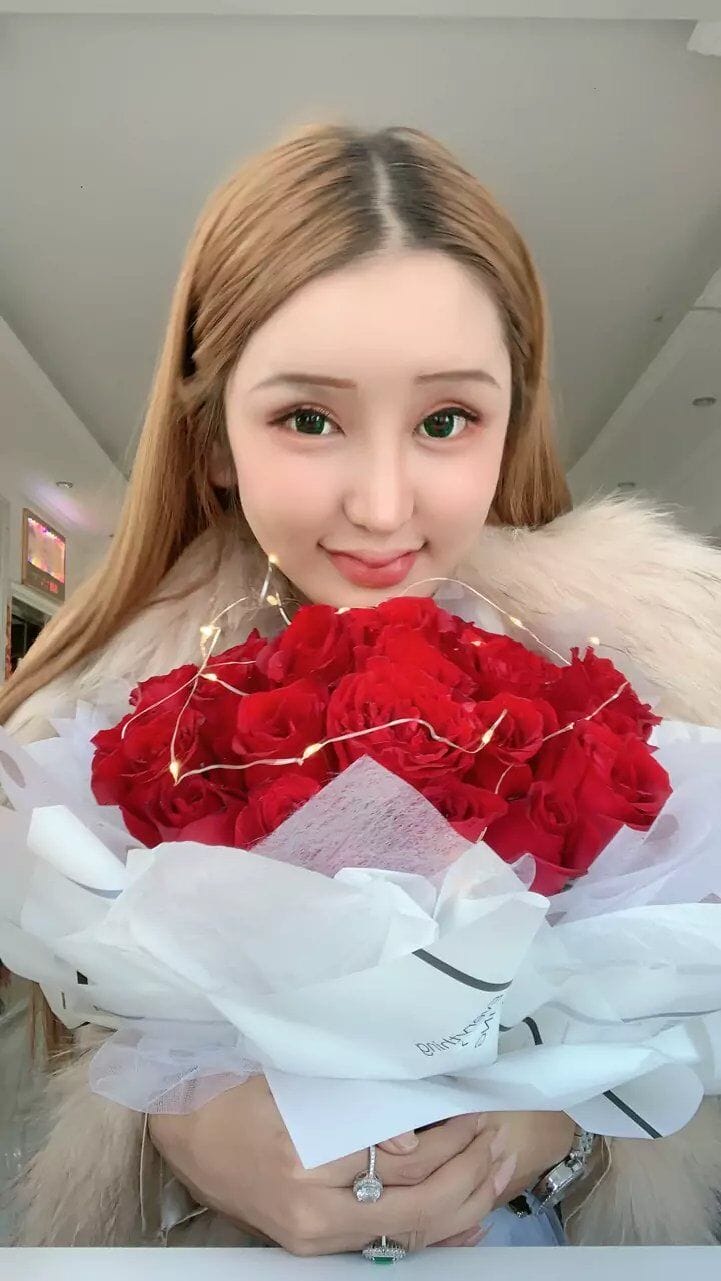 桃花宝宝因为什么整容(桃花宝宝整容失败图片) 桃花宝宝因为什么整容(桃花宝宝整容失败图片)
