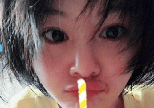 演员的诞生里郑爽的嘴角怎么了?演员的诞生(演员的诞生郑爽嘴巴怎么了) 演员的诞生里郑爽的嘴角怎么了?演员的诞生(演员的诞生郑爽嘴巴怎么了)