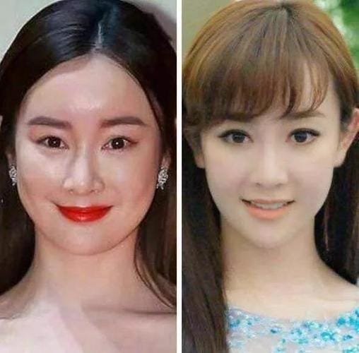 郑爽整容疤痕,郑爽的整容医师,本文共(4255字) 郑爽整容疤痕,郑爽的整容医师,本文共(4255字)