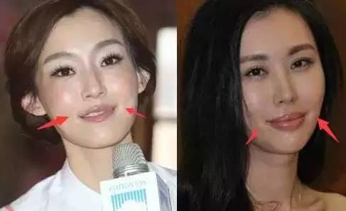 微整老了以后真可怕图片,整容医生都不整容是真的吗? 本文共(1089字) 微整老了以后真可怕图片,整容医生都不整容是真的吗? 本文共(1089字)
