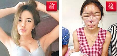 微整老了以后真可怕图片,整容医生都不整容是真的吗? 本文共(1089字) 微整老了以后真可怕图片,整容医生都不整容是真的吗? 本文共(1089字)