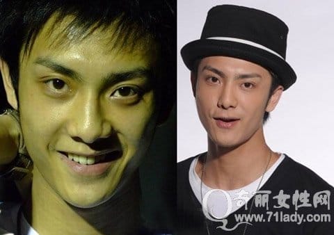 姜潮整容前后对比照片(姜潮什么脸型) 姜潮整容前后对比照片(姜潮什么脸型)