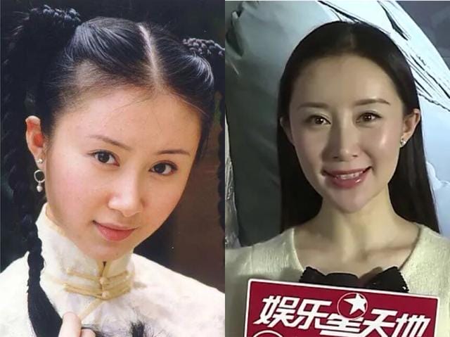 邵音音整容失败,香港整容失败女明(香港明星整容失败音音) 邵音音整容失败,香港整容失败女明(香港明星整容失败音音)