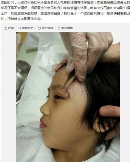 费曼受伤,费曼疤痕还是那么明显(费曼受什么伤) 费曼受伤,费曼疤痕还是那么明显(费曼受什么伤)