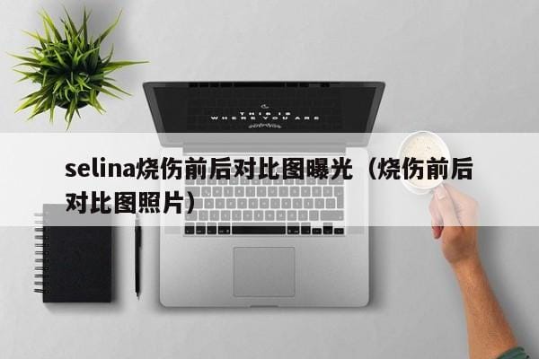 selina烧伤前后对比图曝光(烧伤前后对比图照片) selina烧伤前后对比图曝光(烧伤前后对比图照片)