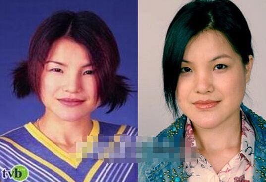 马蹄露下巴怎么了是整容失败导致的吗?她是 马蹄露下巴怎么了是整容失败导致的吗?她是