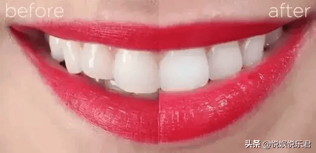 哪款牙膏美白 去黄效果最好(美白去黄效果最好的牙膏排名)(图12) 哪款牙膏美白 去黄效果最好(美白去黄效果最好的牙膏排名)(图12)