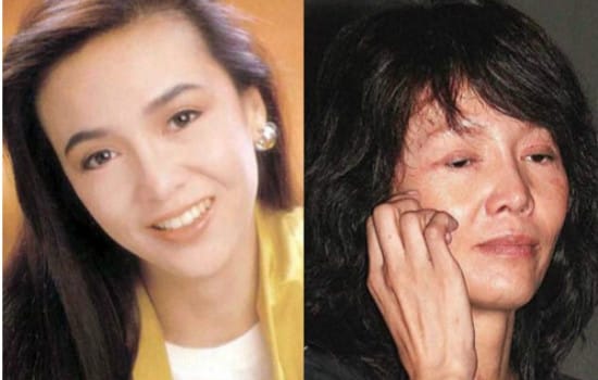 整容后遗症有多可怕?整容老了以后真可怕图 本文共(632字) 整容后遗症有多可怕?整容老了以后真可怕图 本文共(632字)