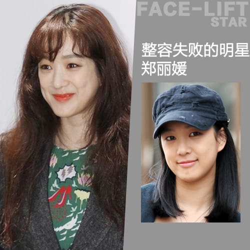 整容后遗症有多可怕?整容老了以后真可怕图 本文共(632字) 整容后遗症有多可怕?整容老了以后真可怕图 本文共(632字)
