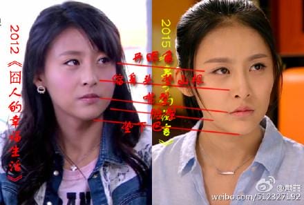 贾青整容前后,美容真心话贾青,本文共(526字) 贾青整容前后,美容真心话贾青,本文共(526字)
