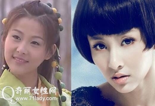 贾青整容前后,美容真心话贾青,本文共(526字) 贾青整容前后,美容真心话贾青,本文共(526字)