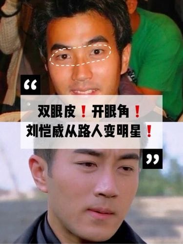 刘恺威整容,金城武双眼皮,本文共(2080字) 刘恺威整容,金城武双眼皮,本文共(2080字)