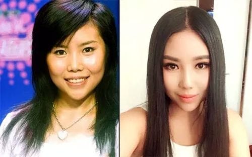 纪敏佳整容前后,温淑梅整形失败(纪敏佳是不是整容了) 纪敏佳整容前后,温淑梅整形失败(纪敏佳是不是整容了)