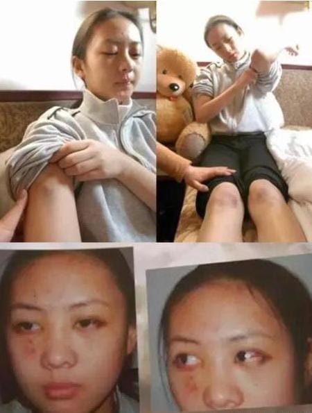 张默暴打女友童瑶,童瑶事件真相(当年童瑶被张默打原因是什么?童瑶张默什么关系) 张默暴打女友童瑶,童瑶事件真相(当年童瑶被张默打原因是什么?童瑶张默什么关系)