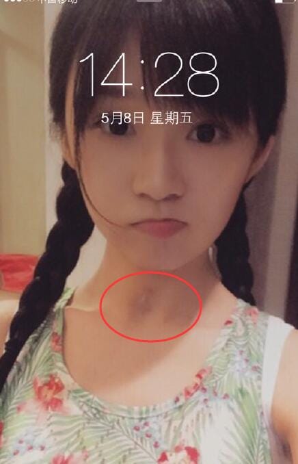 宋伊人如何考上北大的?宋伊人脖子上的伤疤 宋伊人如何考上北大的?宋伊人脖子上的伤疤