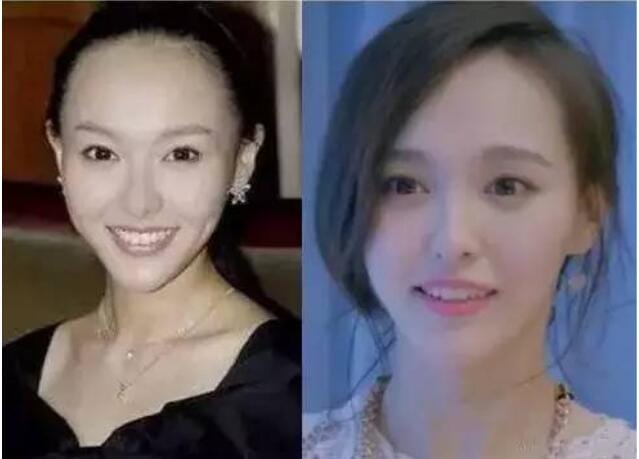 唐嫣为什么叫83、唐总?唐嫣为什么植发种 唐嫣为什么叫83、唐总?唐嫣为什么植发种