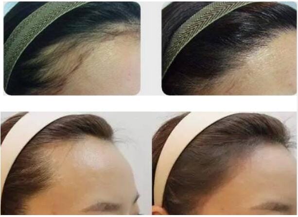 唐嫣为什么叫83、唐总?唐嫣为什么植发种 唐嫣为什么叫83、唐总?唐嫣为什么植发种