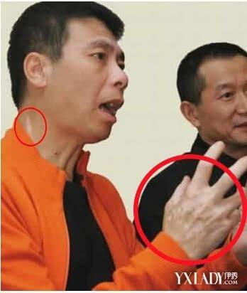 冯小刚脸上,冯小刚脸是全白还是好(冯小刚皮肤怎么那么白) 冯小刚脸上,冯小刚脸是全白还是好(冯小刚皮肤怎么那么白)