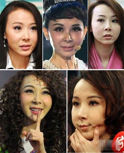 张瑞希整容失败,整容失败的女明星(张瑞希为什么那么漂亮) 张瑞希整容失败,整容失败的女明星(张瑞希为什么那么漂亮)