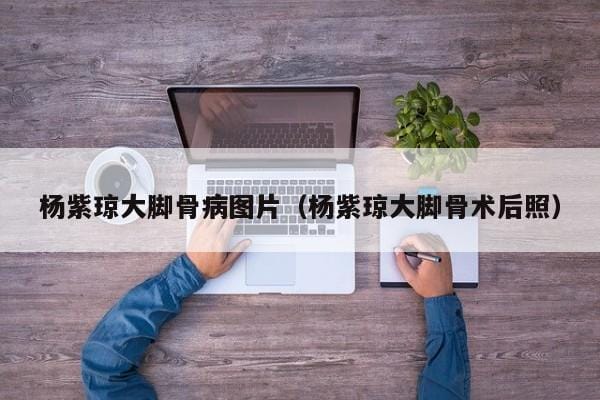 杨紫琼大脚骨病图片(杨紫琼大脚骨术后照) 杨紫琼大脚骨病图片(杨紫琼大脚骨术后照)