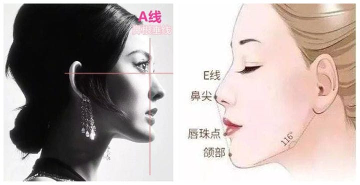 完美侧颜标准角度(侧脸杀是什么意思)(图5) 完美侧颜标准角度(侧脸杀是什么意思)(图5)