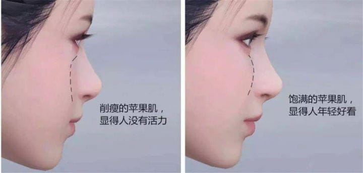 完美侧颜标准角度(侧脸杀是什么意思)(图7) 完美侧颜标准角度(侧脸杀是什么意思)(图7)