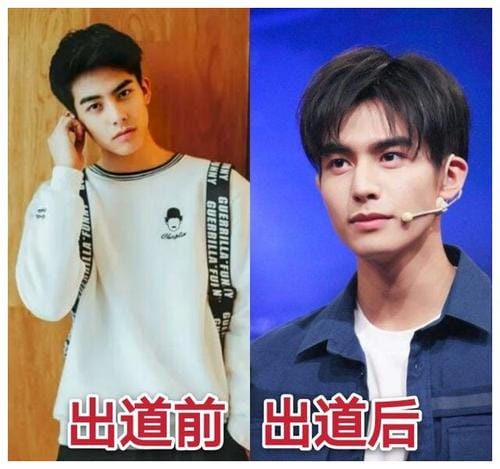 朴灿烈整容 o 朴灿烈整容 o