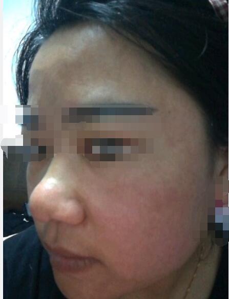 蒜头鼻是不是没有鼻梁?蒜头鼻子的女人面相好吗? 本文共(1005字) 蒜头鼻是不是没有鼻梁?蒜头鼻子的女人面相好吗? 本文共(1005字)