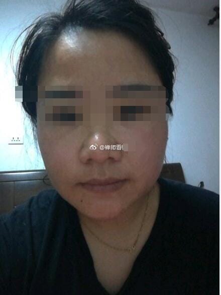 蒜头鼻是不是没有鼻梁?蒜头鼻子的女人面相好吗? 本文共(1005字) 蒜头鼻是不是没有鼻梁?蒜头鼻子的女人面相好吗? 本文共(1005字)