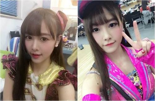 唐安琪烧伤,唐安琪烧伤照片(识别) 唐安琪烧伤,唐安琪烧伤照片(识别)