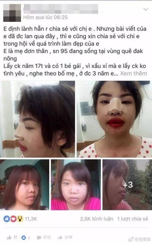 凤姐整容后的照片,弯弯姐整容前后,本文共(7952字) 凤姐整容后的照片,弯弯姐整容前后,本文共(7952字)