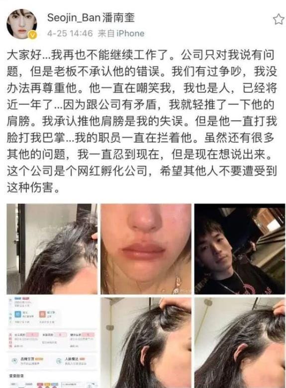 潘南奎为什么叫花蛇(潘南奎花蛇是什么意思) 潘南奎为什么叫花蛇(潘南奎花蛇是什么意思)