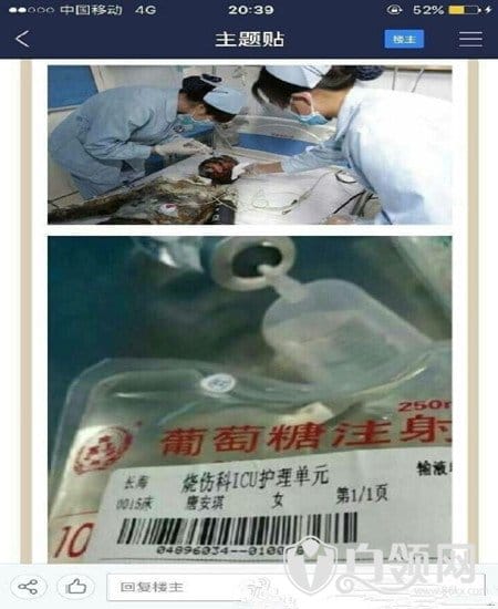 唐安琪烧伤照片流出,唐安琪现在情况伤势怎样了 本文共(874字) 唐安琪烧伤照片流出,唐安琪现在情况伤势怎样了 本文共(874字)