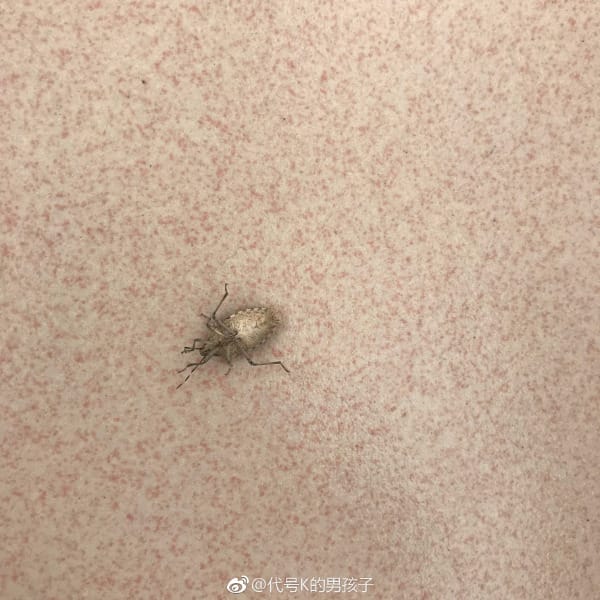 臭虫咬的包是啥样子,晚上怎么预防臭虫咬? 本文共(963字) 臭虫咬的包是啥样子,晚上怎么预防臭虫咬? 本文共(963字)