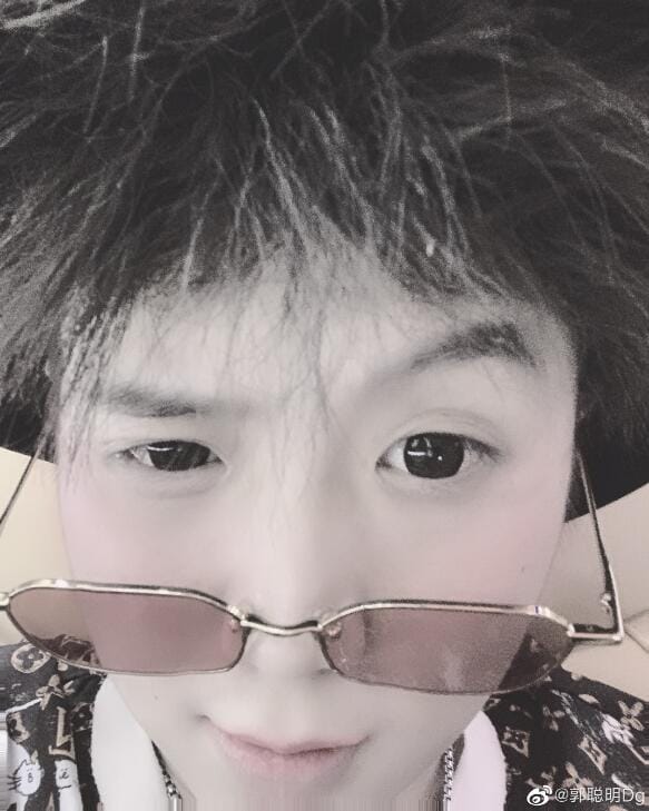 抖音郭聪明的眼睛是怎么回事戴美瞳了吗 抖音郭聪明的眼睛是怎么回事戴美瞳了吗