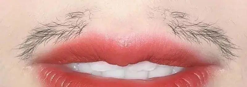 女性嘴唇上长“小胡子”别乱刮（女生胡子能不能刮掉）(图5)