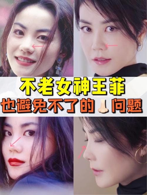 王菲整容 od 王菲整容 od