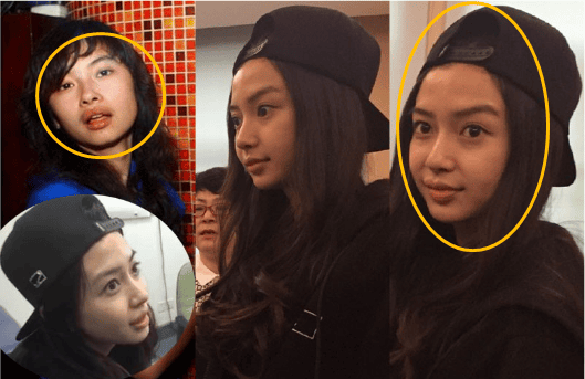 angelababy整容前,ba(ANGELABABY整容前照片) angelababy整容前,ba(ANGELABABY整容前照片)