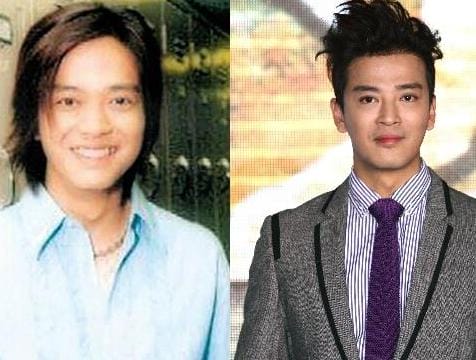陈晓东整容前后对比照片(陈晓 整容) 陈晓东整容前后对比照片(陈晓 整容)