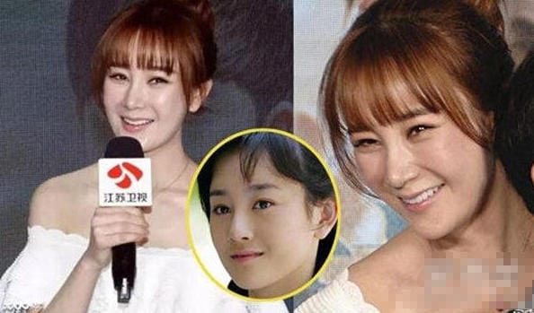 张檬整容前后对比照片(张檬整容前后照片) 张檬整容前后对比照片(张檬整容前后照片)