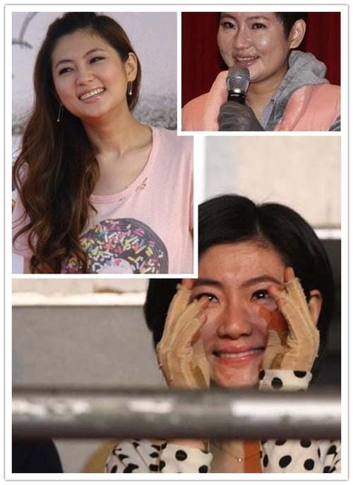 selina烧伤疤痕,Selin(selina脸部有烧伤吗) selina烧伤疤痕,Selin(selina脸部有烧伤吗)