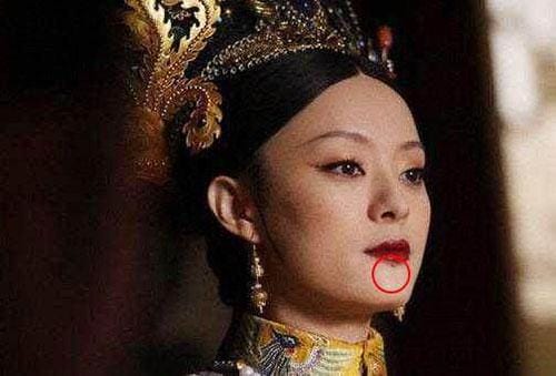 孙俪车祸留下的疤痕图片(孙俪眼角的疤近照)
