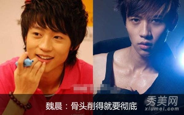 魏晨整容前后的照片，花花整容前照片曝光,本文共（2021字）