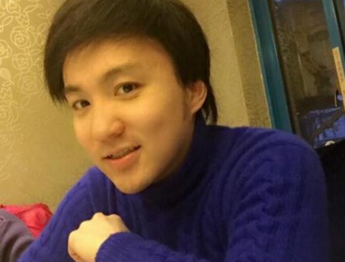 孟智超早期秃顶照片被曝光 孟智超早期秃顶照片被曝光
