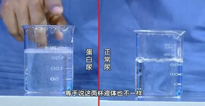 尿有泡沫就一定是蛋白尿吗?泡沫尿和蛋白尿的区别 本文共(884字) 尿有泡沫就一定是蛋白尿吗?泡沫尿和蛋白尿的区别 本文共(884字)