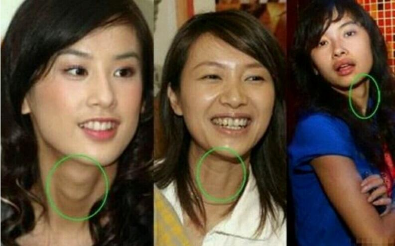 李奈映为什么有喉结 李奈映为什么有喉结