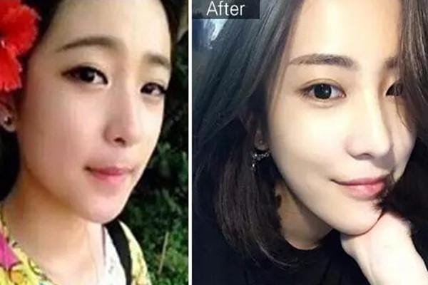 王柳雯整容前后对比图(王柳雯早期图片) 王柳雯整容前后对比图(王柳雯早期图片)