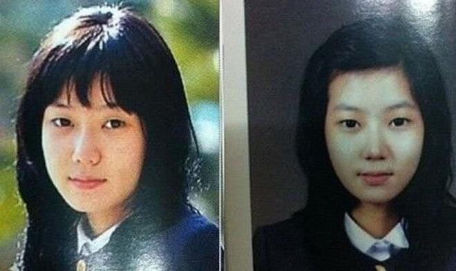 林秀香整容前后的照片对比图(林秀香的脸) 林秀香整容前后的照片对比图(林秀香的脸)