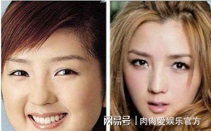 尚雯婕整容前,尚雯婕整容(尚雯婕整容前什么脸型)
